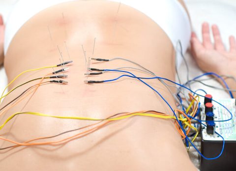 Acupunctura si electronica-partea a doua